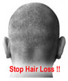 Stop hair loss